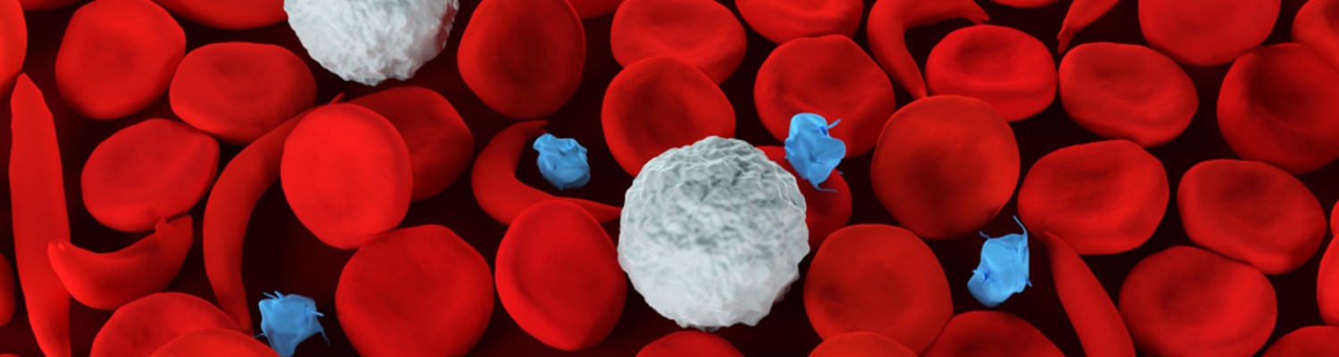 ¿Qué es la anemia falciforme?